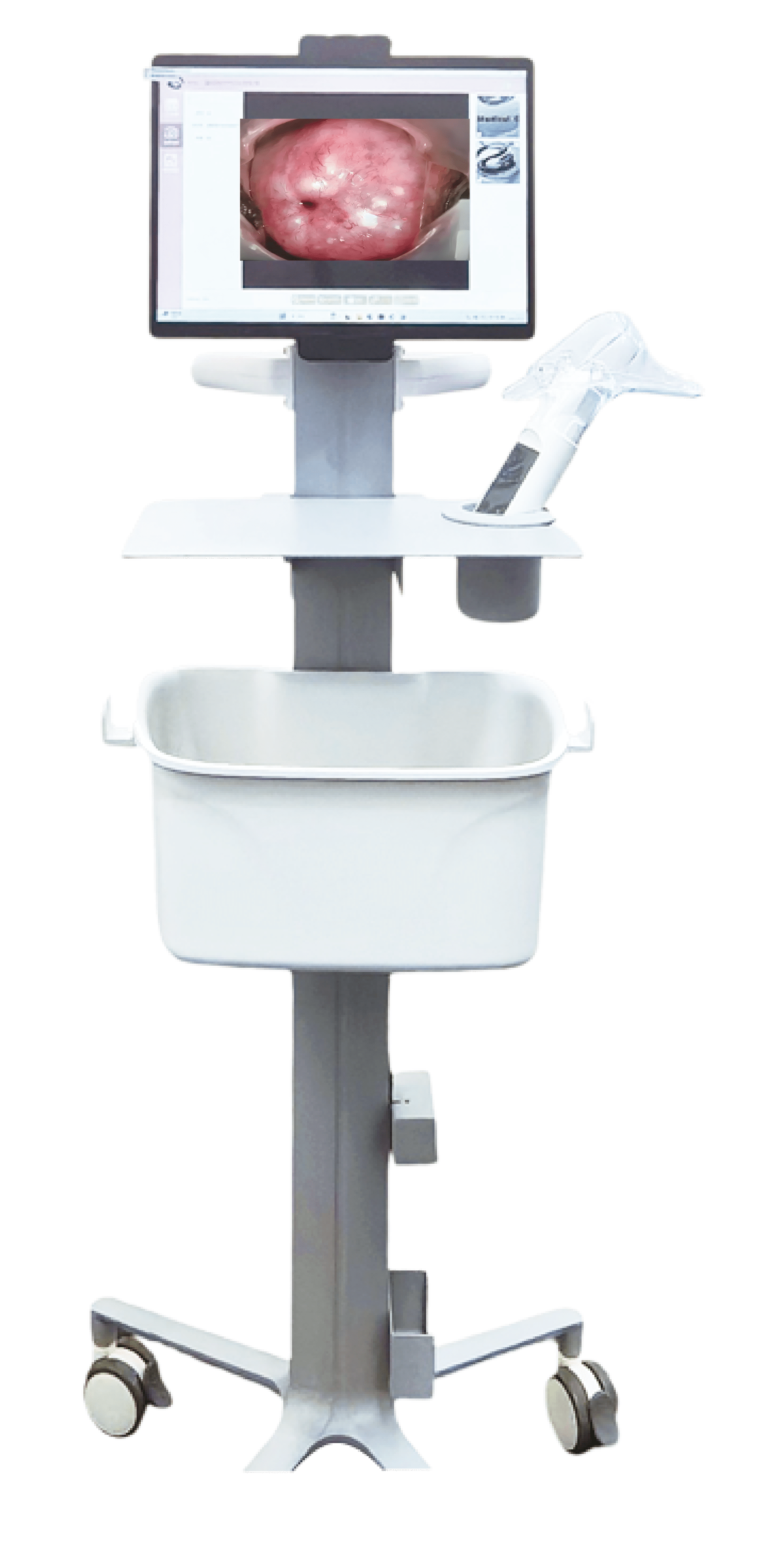 Portable Electronic Colposcope